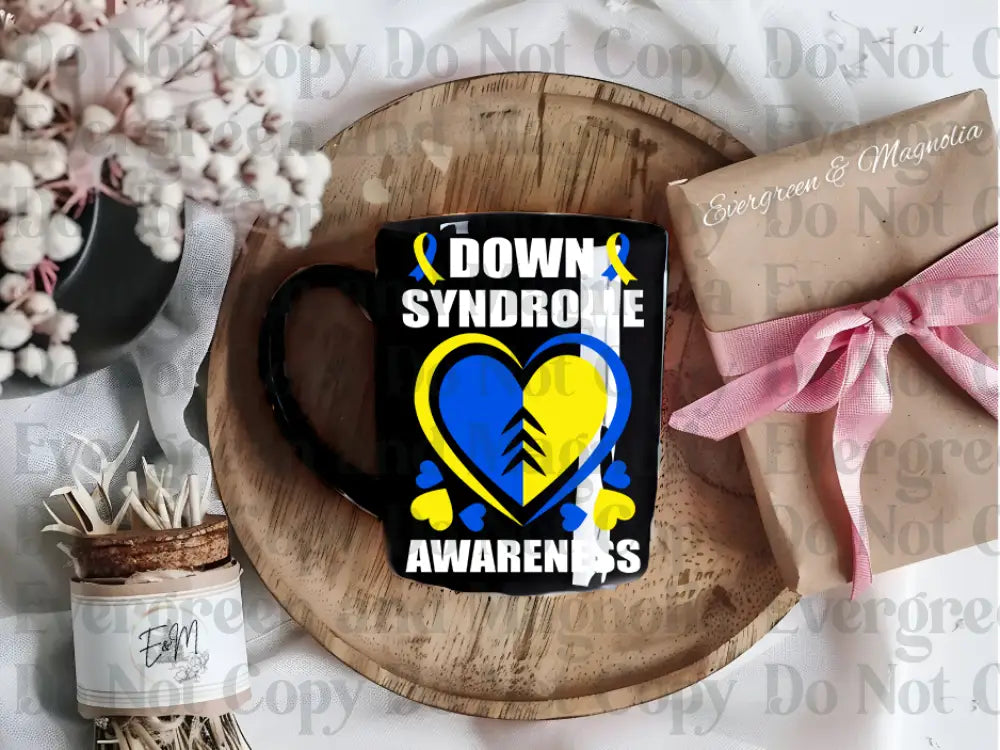 Down's Syndrome 86