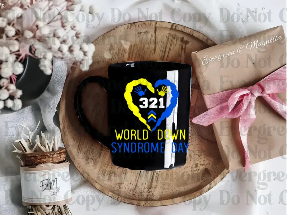 Down's Syndrome 30